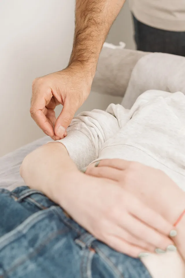 Acupuncture
